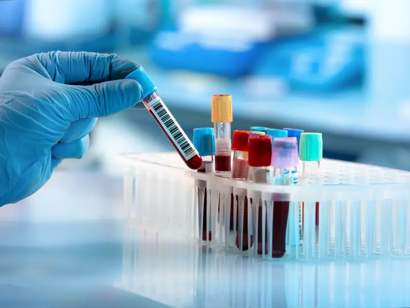 Educational theme | The role of ctDNA in lymphoma management