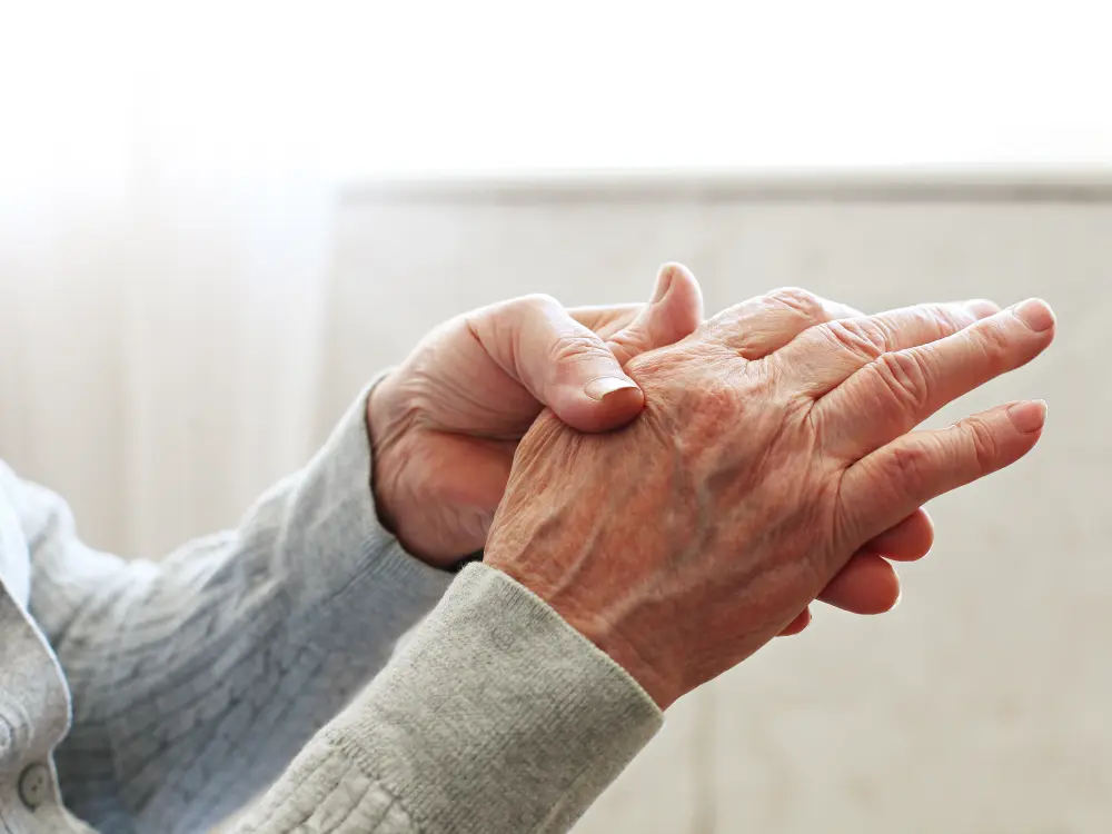 LAMDA as an SLE-related arthritis disease measure