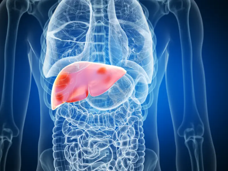 The diagnostic value of dd-cfDNA in liver transplant rejection