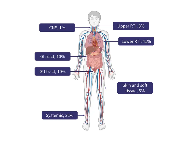 Infections following bispecific antibody therapy in MM: incidence and characteristics