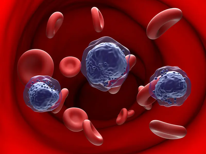 Venetoclax exposure reduced to 7 days vs standard exposure in patients with newly diagnosed AML