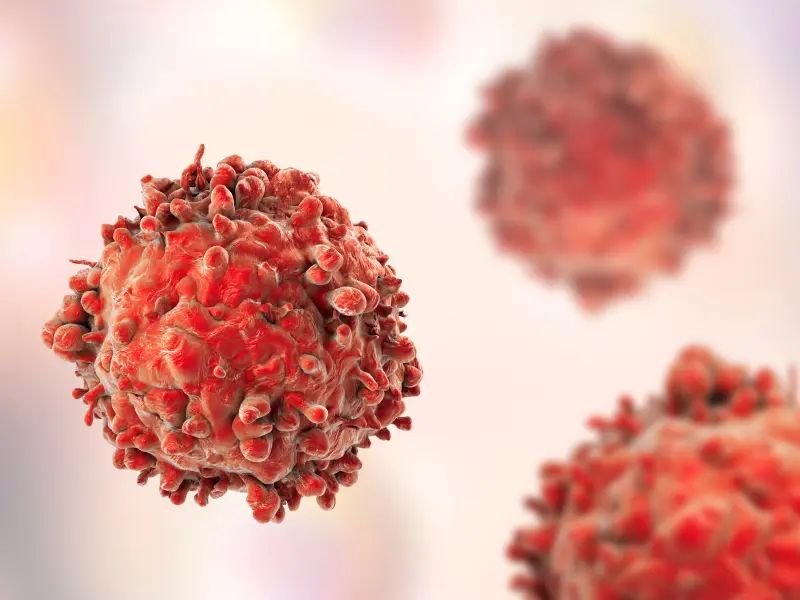 Tisagenlecleucel in pediatric and young adult patients with Down syndrome-associated relapsed/refractory acute lymphoblastic leukemia