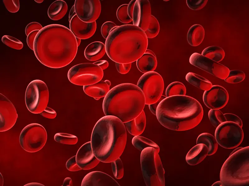 PV-ARC: ELN Clinical Signs and Symptoms for thrombotic risk in patients with PV treated with HU
