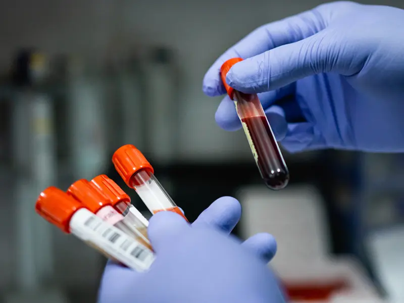VERIFY phase III part 1a: Rusfertide vs placebo for phlebotomy-dependent PV
