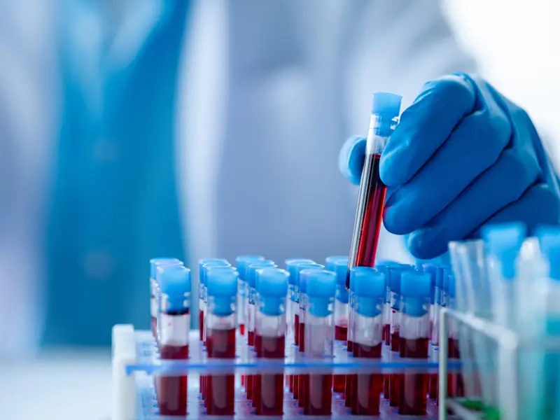Quantum First Efficacy Analysis In Newly Diagnosed Flt3 Itd Positive Aml Quantum First Efficacy Analysis In Newly Diagnosed Flt3 Itd Positive Aml