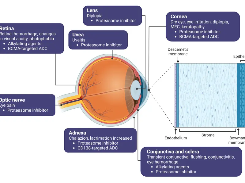 Identifying and managing ocular toxicities in patients with MM