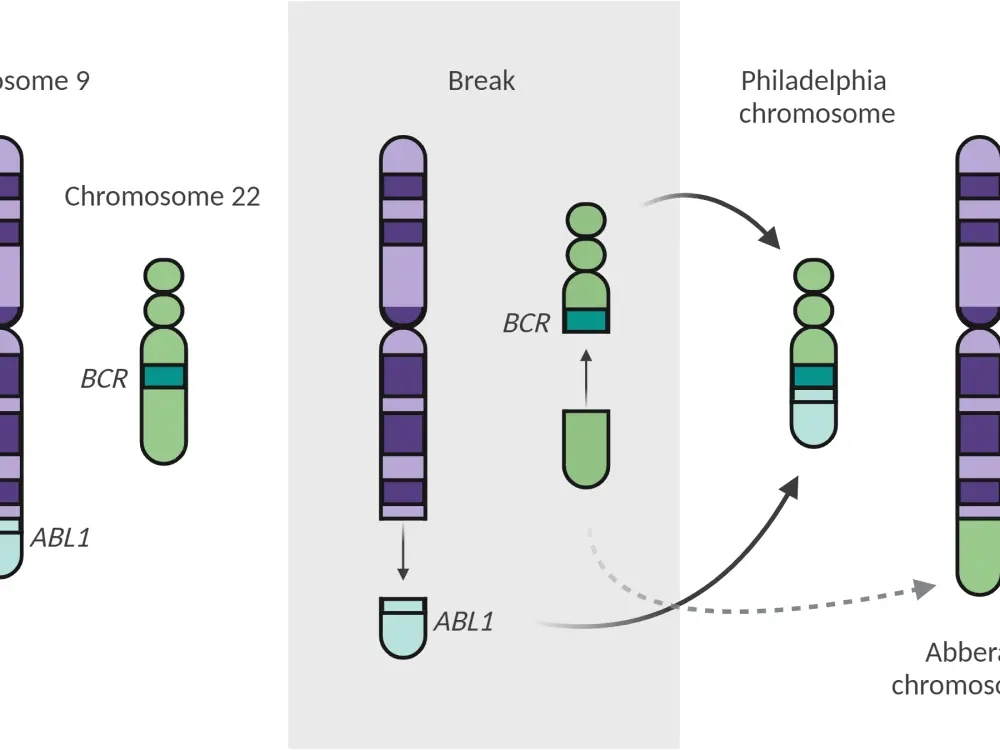 Ph-positive ALL: an overview of the genomic landscape