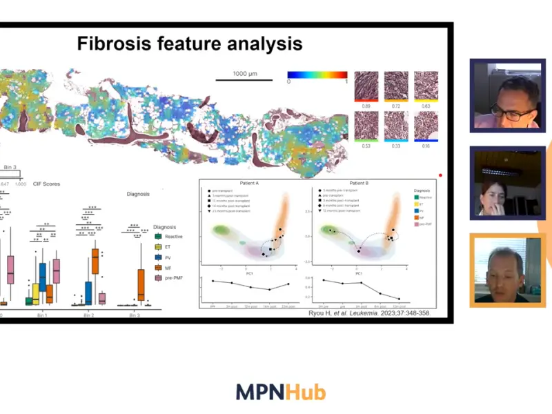 The role of AI in the future of MPN bone marrow histopathology