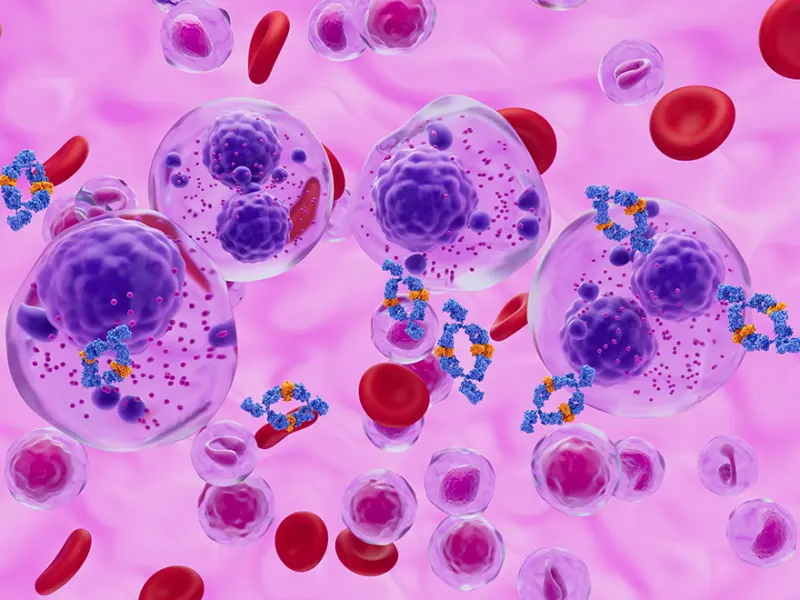 Real-world efficacy of Isa-Kd in patients with RRMM