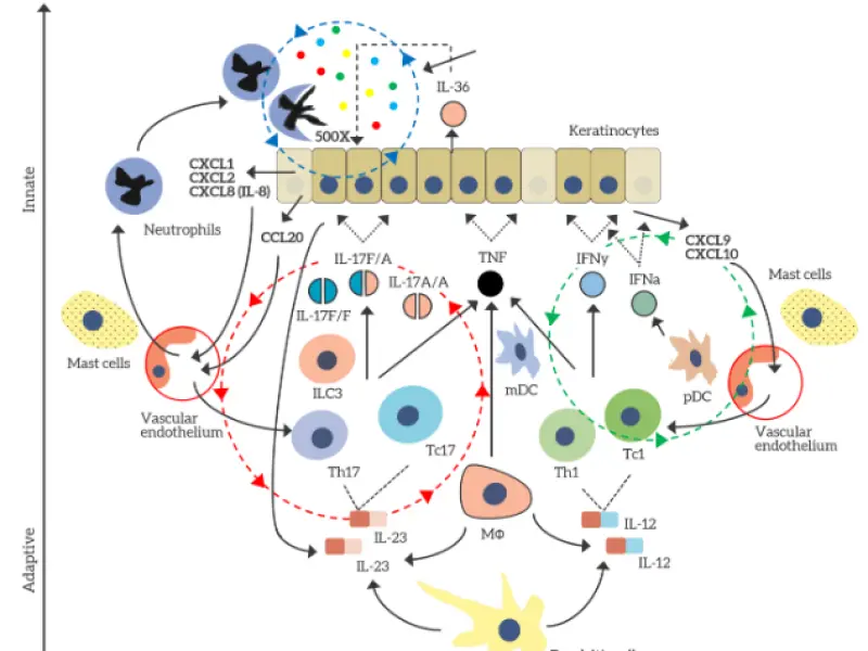 An overview of the epidemiology, diagnosis, classification, and management of psoriasis  