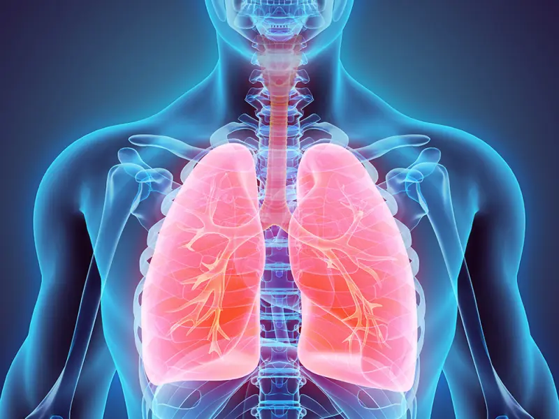 Molecular biopsy features associated with BLAD in lung transplant recipients