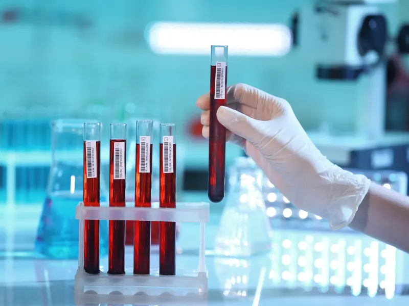 High MRD-negativity rates observed with wKRd-D for patients with newly diagnosed multiple myeloma  