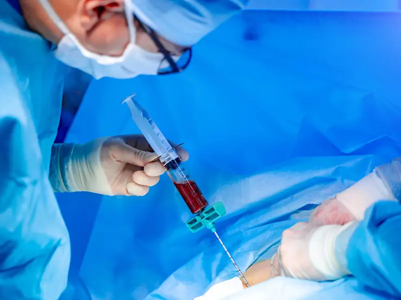 Impact of donor type on transplant outcomes in patients with MF