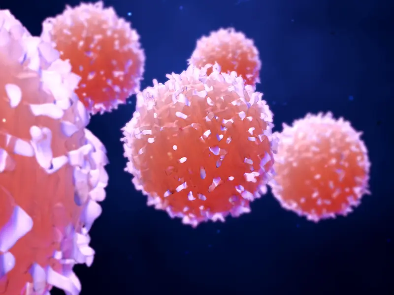 An update of Italian best practice recommendations for ECP use in GvHD 