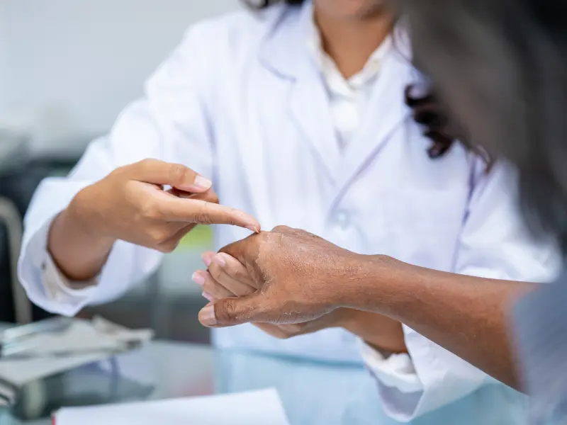 The use of patient-reported outcomes as a prognostic marker in cutaneous cGvHD