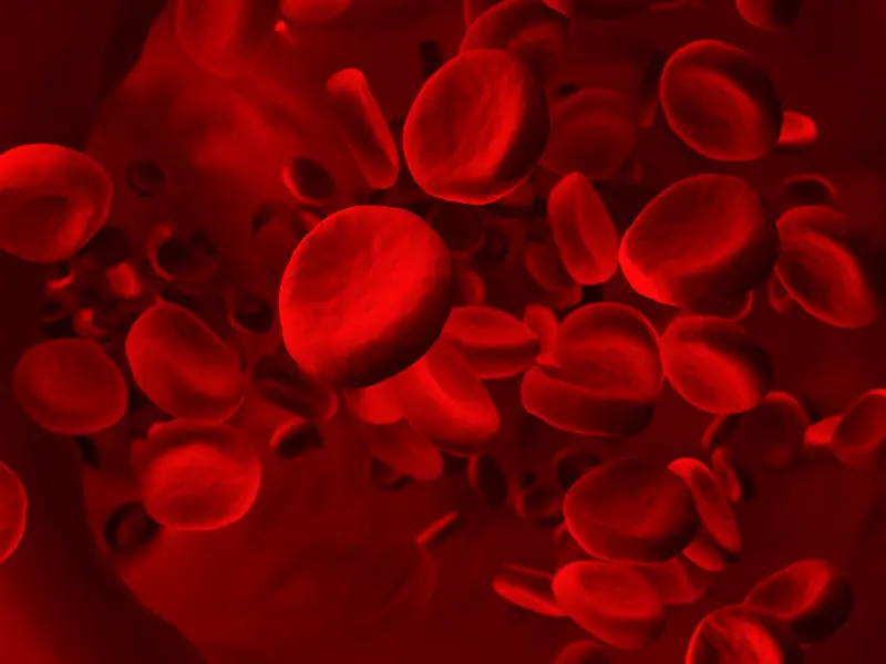 Incidence of blast-phase disease in myelofibrosis, according to anemia severity