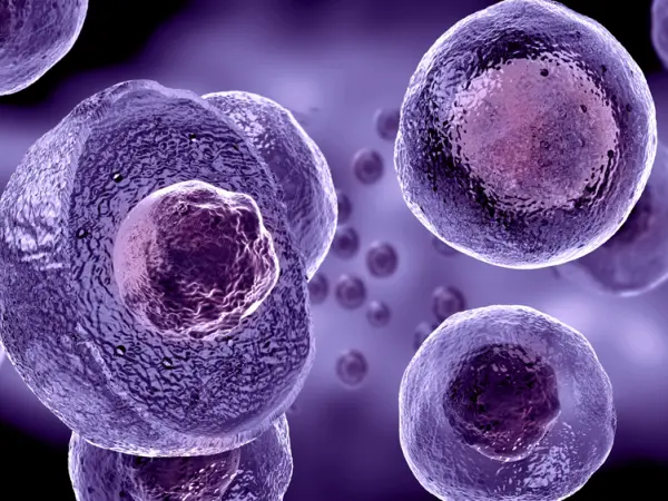 Hodgkin lymphoma
