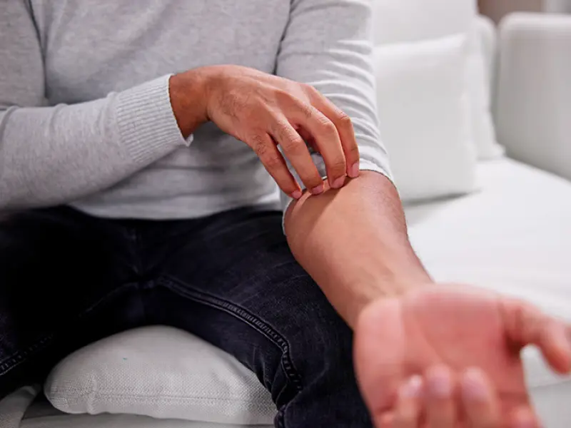 LIMMitless long-term results: Continuous risankizumab in moderate-to-severe plaque psoriasis