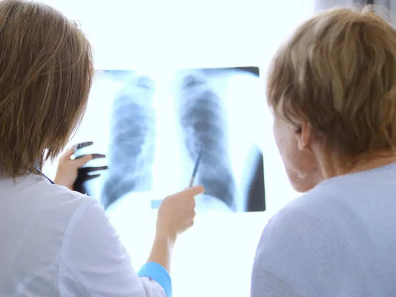Managing pulmonary cGvHD post-HSCT: A stepwise approach