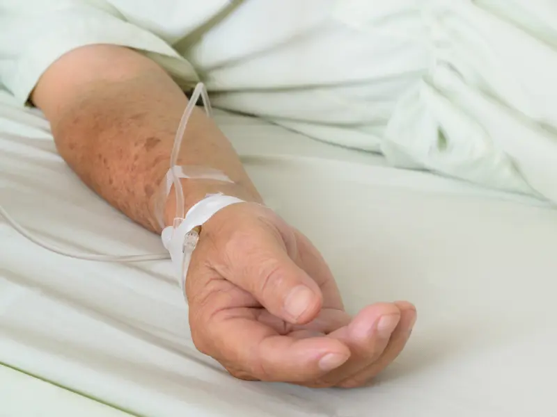 The efficacy and safety of mogamulizumab for advanced mycosis fungoides and Sézary syndrome