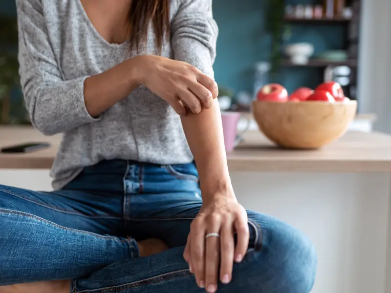 The DERMIS trials of roflumilast for chronic plaque psoriasis