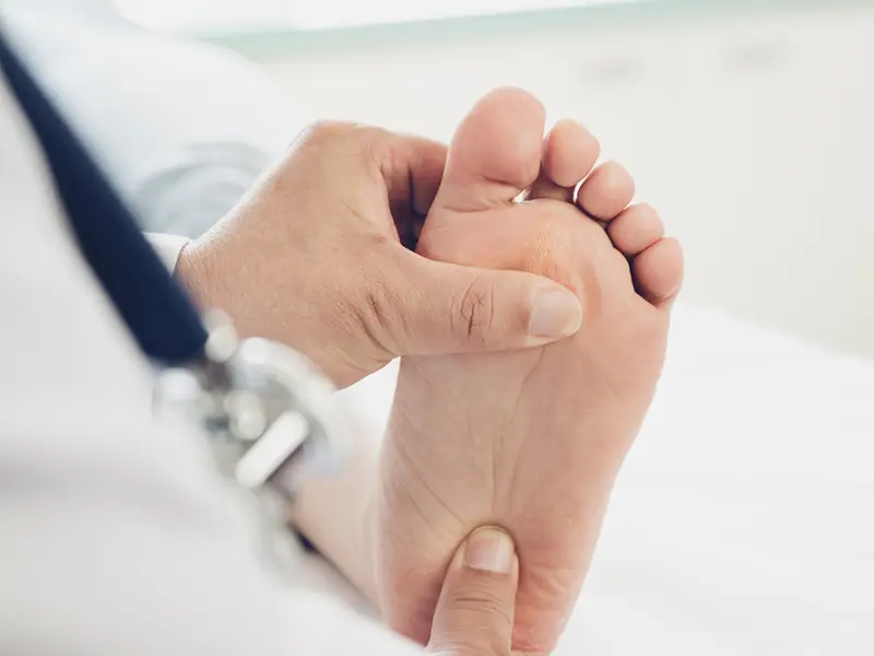 Phase II GAP trial: Guselkumab in palmoplantar pustulosis