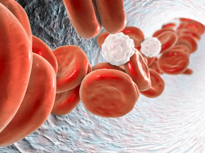 Thrombosis and multiple myeloma