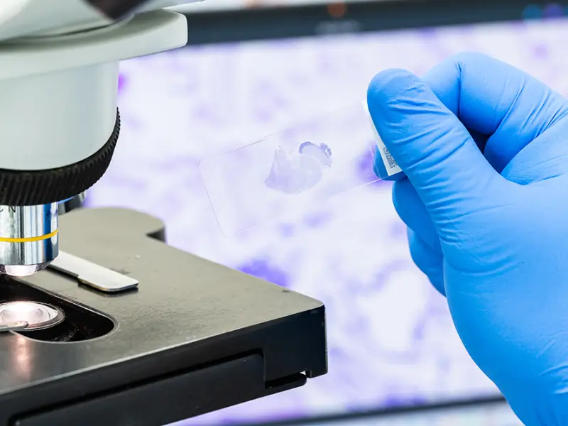FFPE-based molecular diagnosis of heart allograft rejection