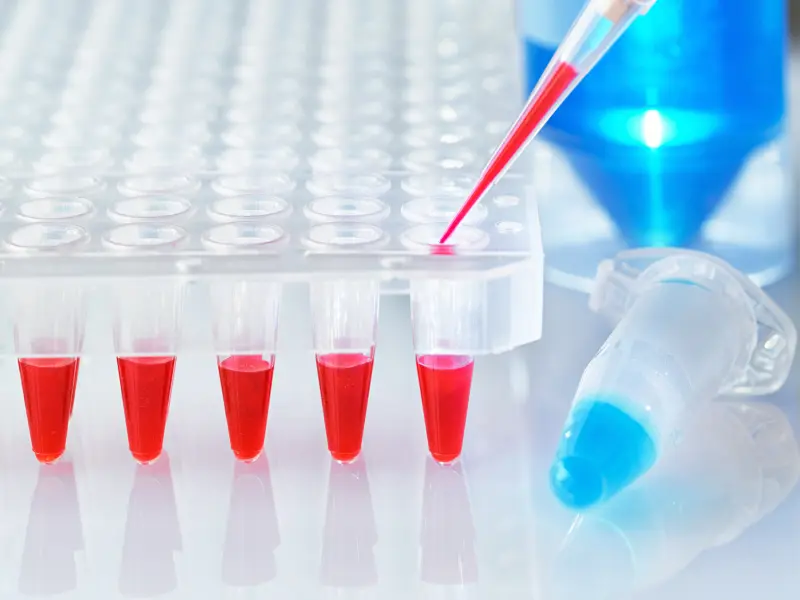 Prognostic significance of clinical patient characteristics and blood biomarkers in SR- and SD-aGvHD (REACH2)