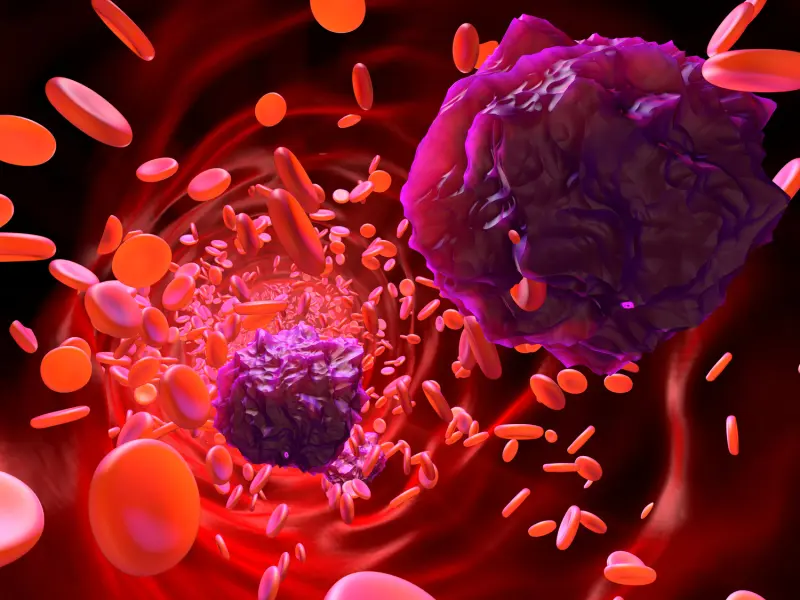 Long-term outcomes following CAR T-cell therapy in B-cell malignancies