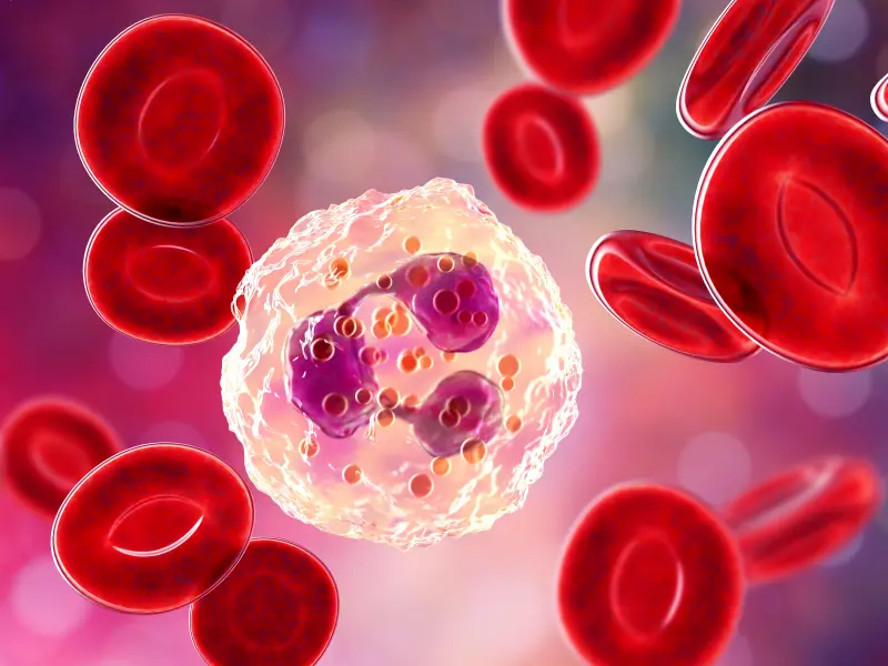 Myelofibrosis: Neutrophil-to-lymphocyte ratio impact on prognosis and discontinuation of ruxolitinib