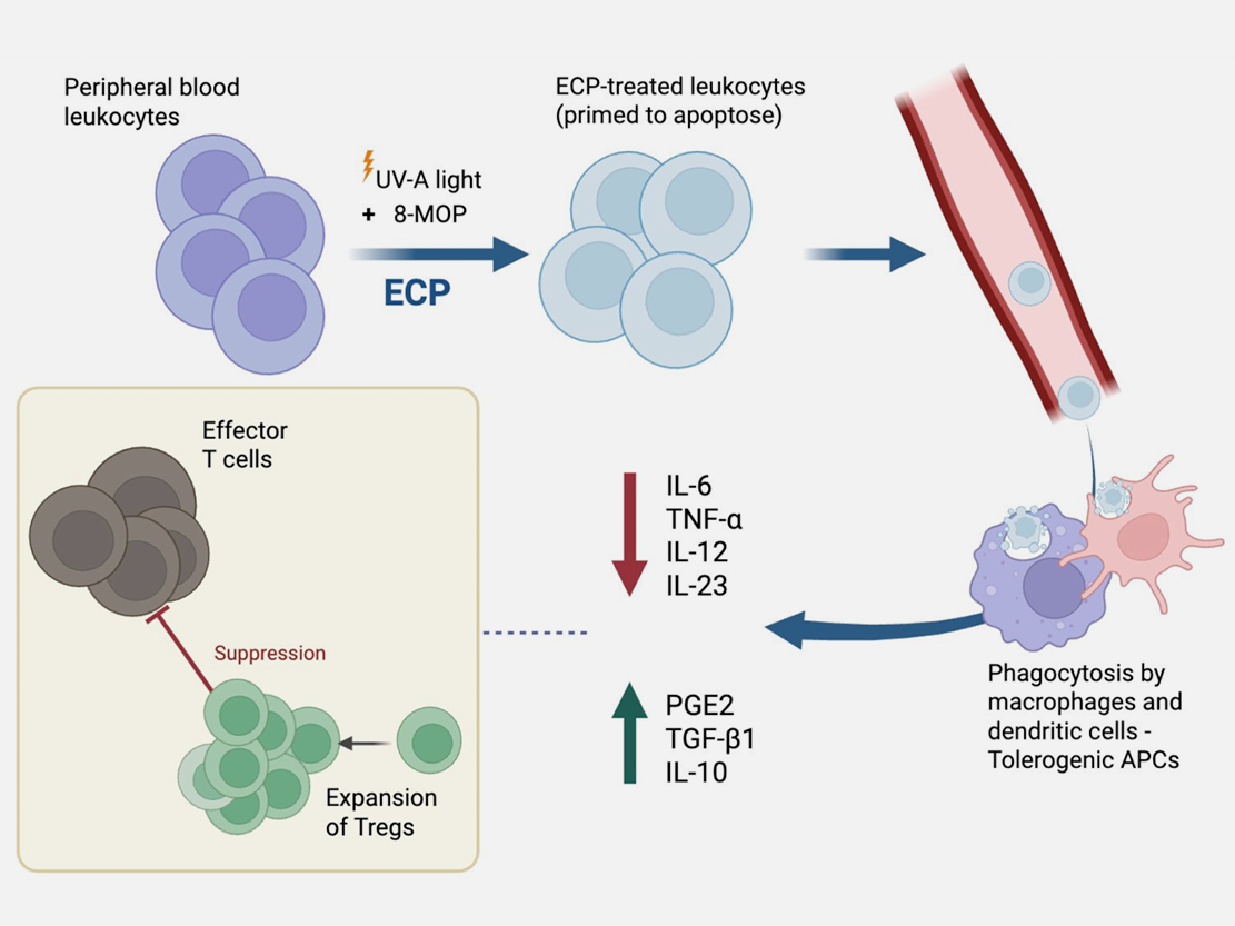 Biomarkers for optimizing ECP treatment for acute and chronic GvHD