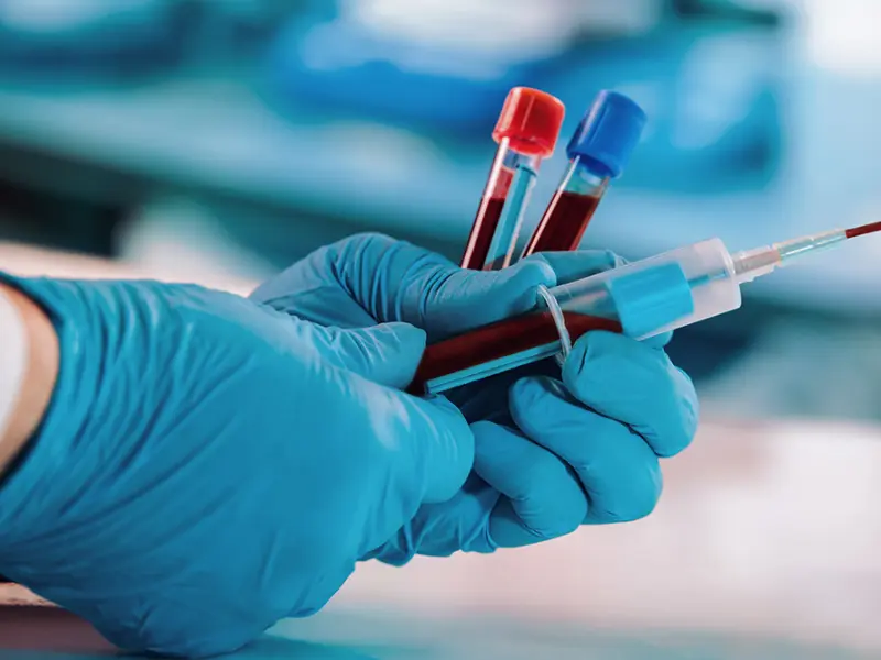 Precision-T phase III subgroup analysis: Orca-T for GvHD prophylaxis