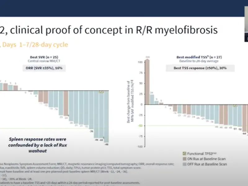 Clinical trial club | Navtemadlin vs best available therapy in relapsed or refractory myelofibrosis
