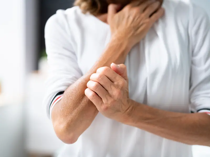 The COMFORT-1 trial: piclidenoson versus apremilast for plaque psoriasis