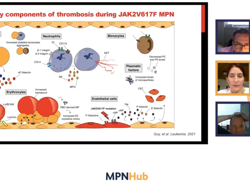 Thrombotic and hemorrhagic complications in MPN