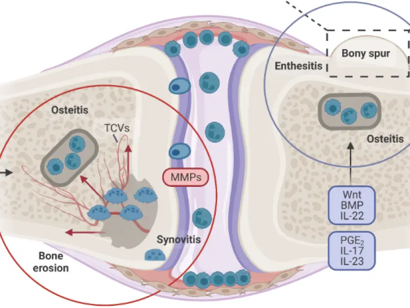 A review of the pathogenesis and molecular targets of psoriatic disease