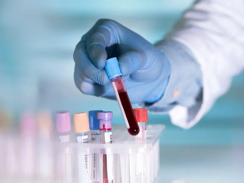 Editorial theme | Impact of using a fixed blast percentage threshold on AML and MDS treatment options 