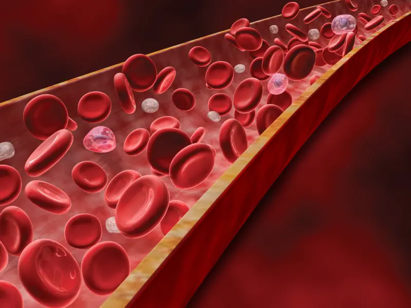 Phase II trial of lenalidomide and dexamethasone combination in naïve CLL patients