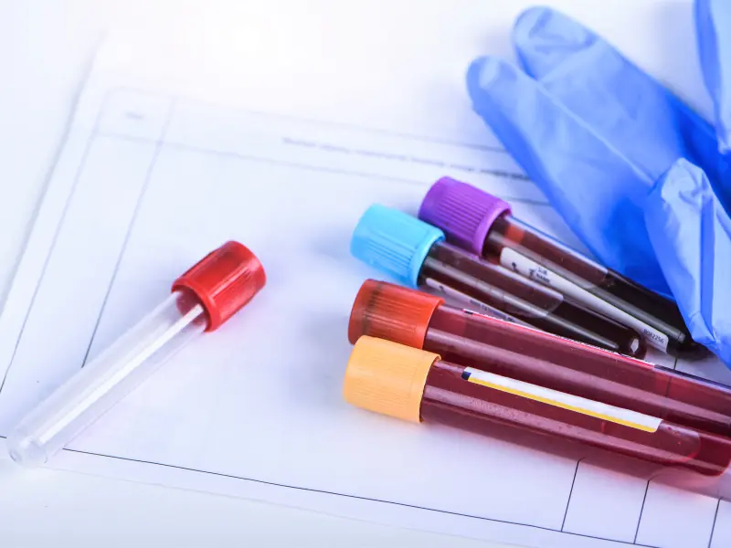 SOHO 2019 | MRD in AML