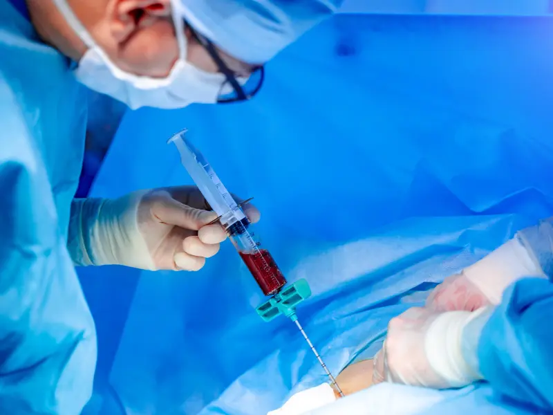 Transplant in patients MF: The next best approach after matched donor allo-HSCT