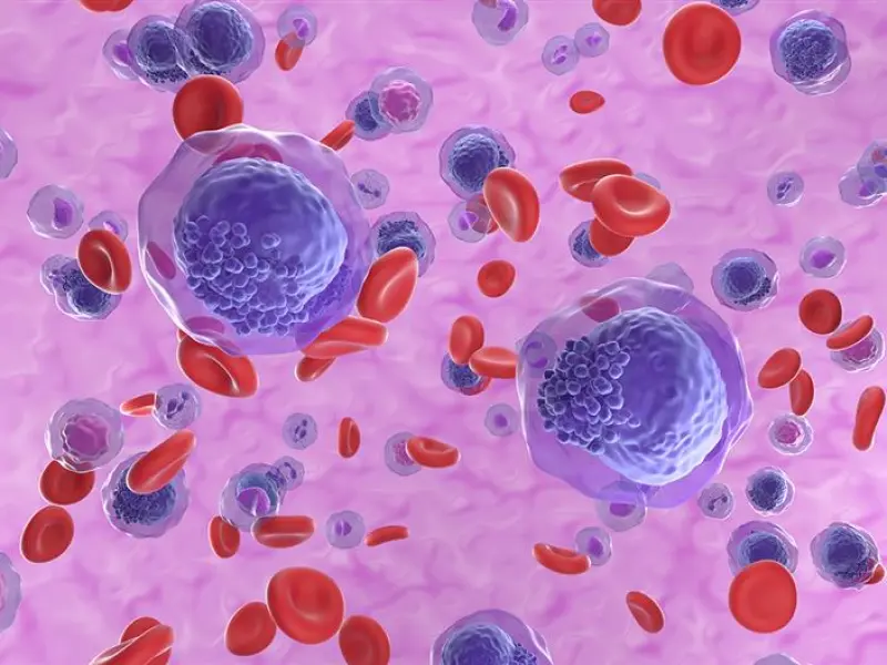 Targeting the menin–KMT2A complex in AML: Current status of emerging therapies