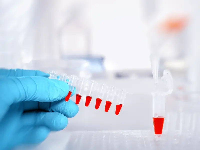The emerging role of MRD in the treatment of chronic lymphocytic leukemia 