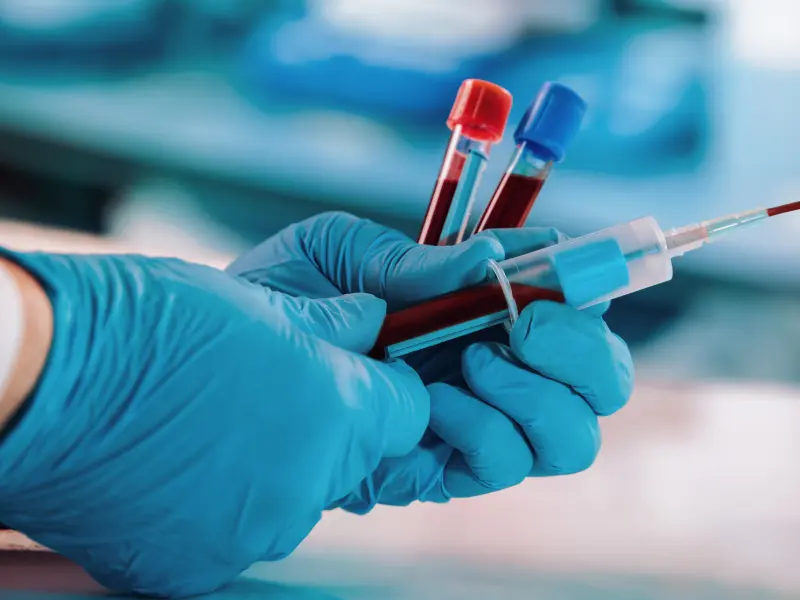 Orca-T in patients undergoing allo-HSCT for hematologic malignancies