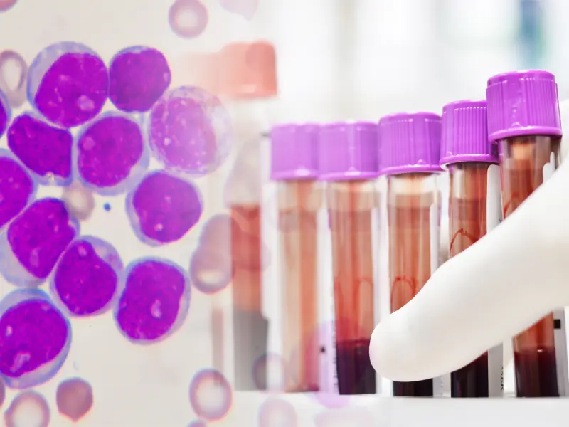 Challenges in the management and treatment of patients with relapsed/refractory DLBCL