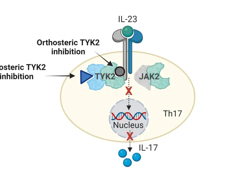 Targeted therapy for psoriasis: A focus on tyrosine kinase 2 inhibitors